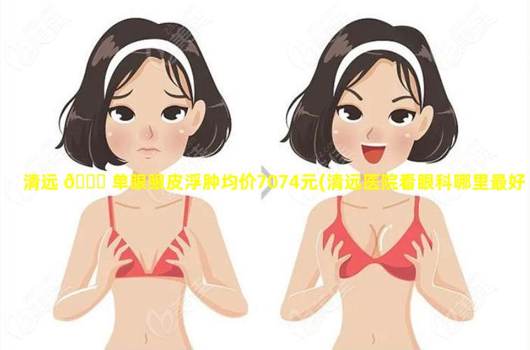 清远 🐝 单眼眼皮浮肿均价7074元(清远医院看眼科哪里最好 🦅 )